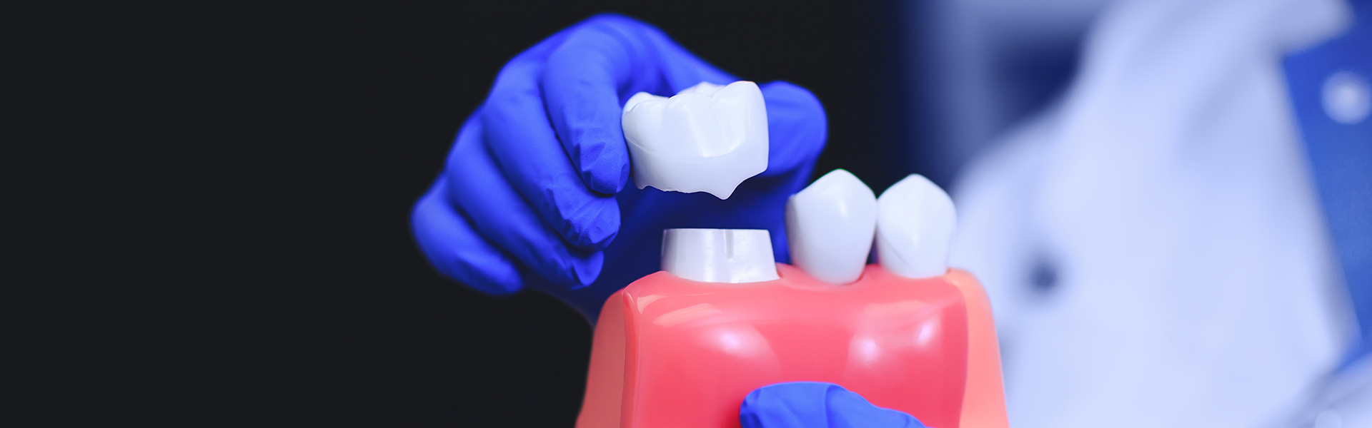 Is Getting a Dental Crown Painful? What You Can Expect in Leesburg, VA